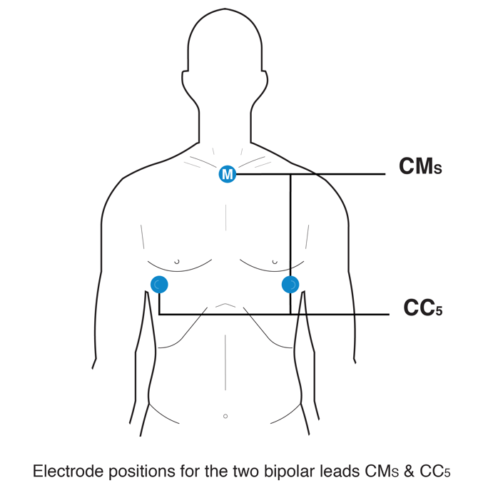 Placement of Hexoskin cardiac sensors