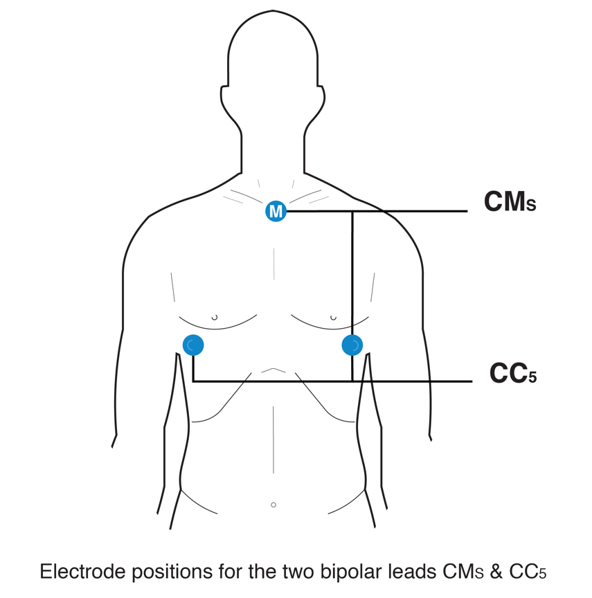 Placement Of Hexoskin Cardiac Sensors